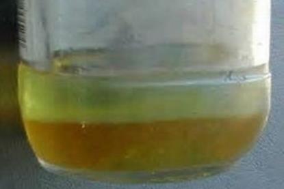 A diesel fuel sample showing water and sediment contamination.